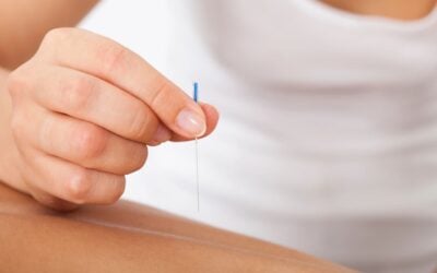 Physiotherapy vs. Acupuncture: Helping You Make the Right Choice