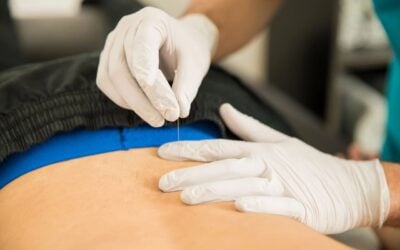 Unlocking the Potential of IMS Therapy for Chronic Nerve Pain Relief in Burnaby